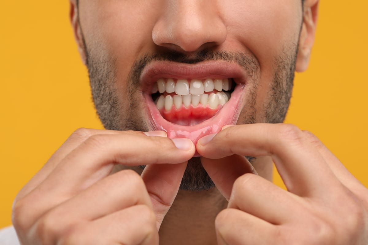 Gum Disease Treatment in Miami Gardens